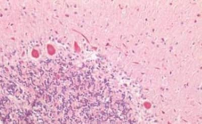 Immunohistochemistry-Paraffin: GRB7 Antibody [NBP3-14366] - Human Brain, Cerebellum: Formalin-Fixed, Paraffin-Embedded (FFPE)